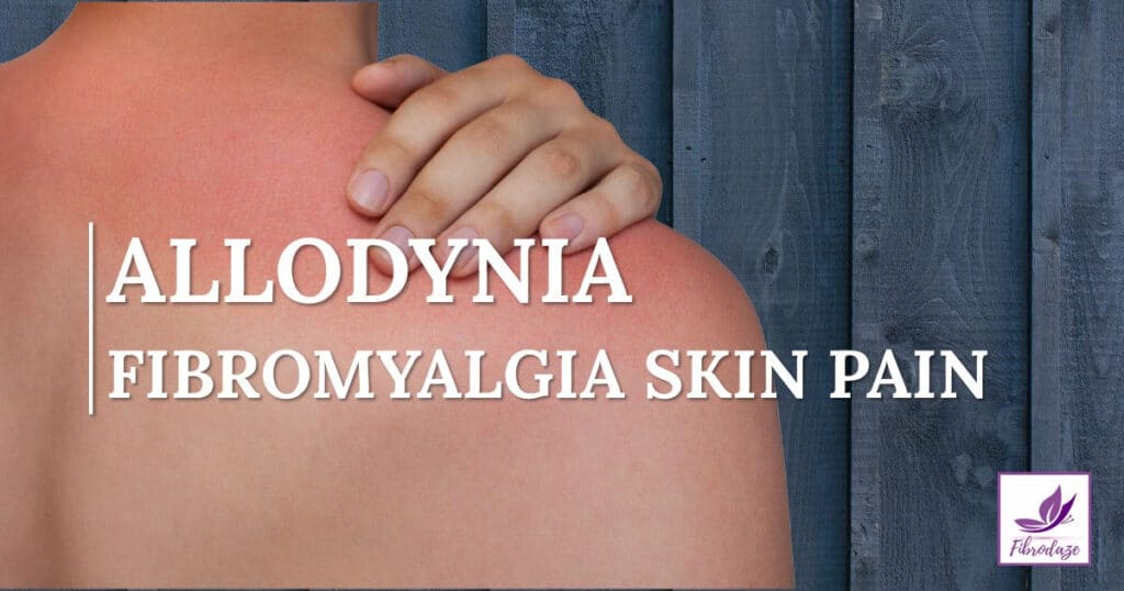 Allodynia: Fibromyalgia Skin Pain