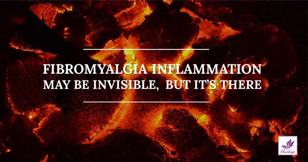 Inflammation In Fibromyalgia May Be Invisible, But It's There