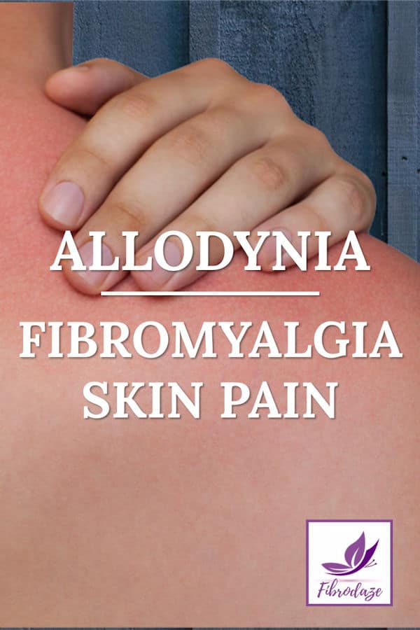 Allodynia: Fibromyalgia Skin Pain
